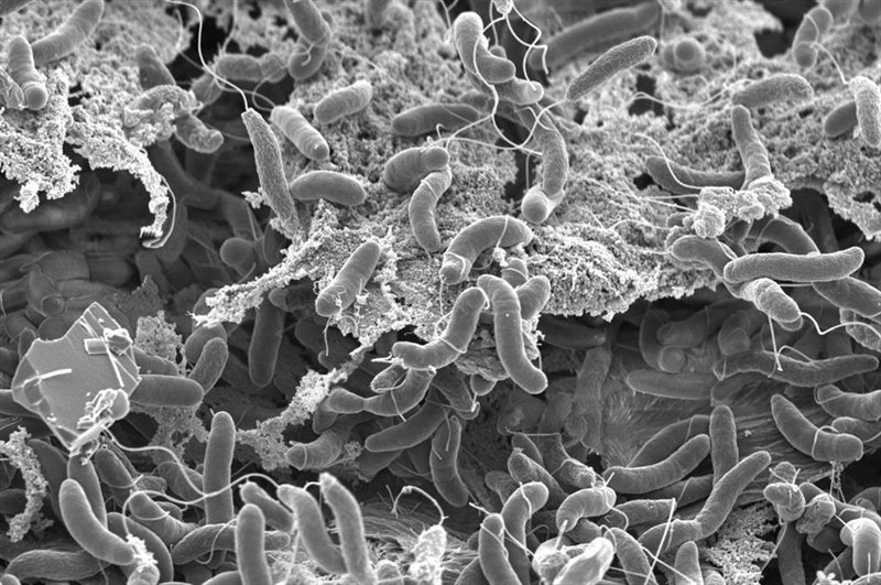 ep vibrio cholerae