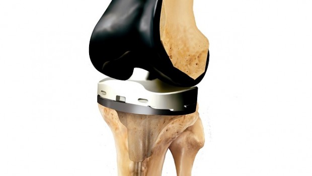 smith nephew knee