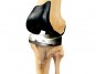 smith nephew knee