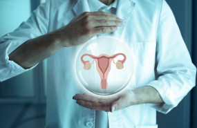 1621250835 ovario 1621250835 ovario