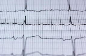 ep electrocardiograma