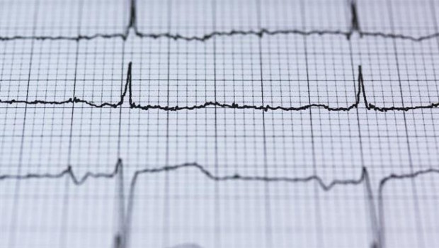 ep electrocardiograma