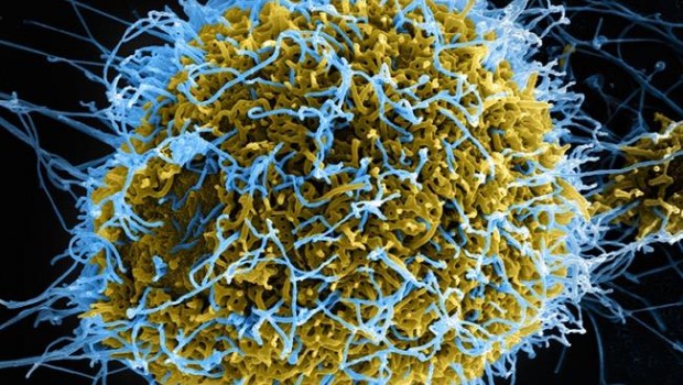 ep filamentosvirus del ebola