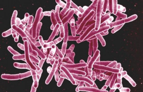 ep mycobacterium tuberculosis 20190827134504