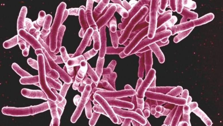 ep mycobacterium tuberculosis 20190827134504