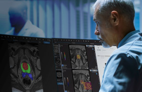 quibim qpprostate screen 