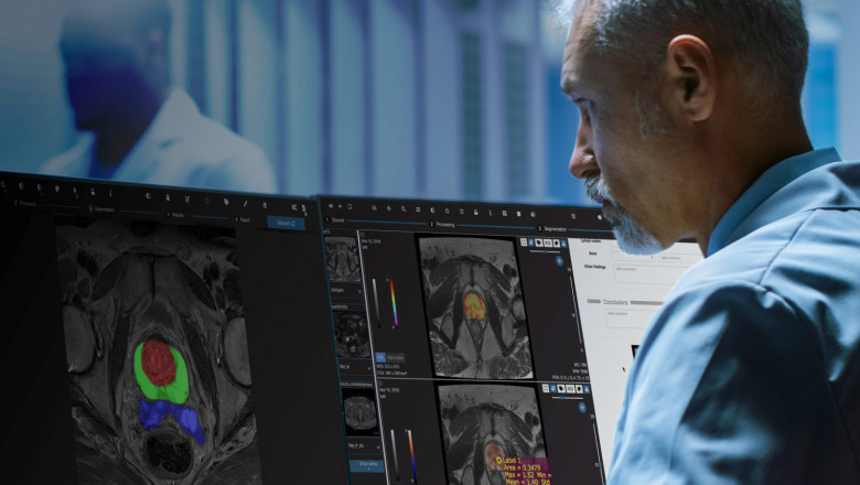 quibim qpprostate screen 