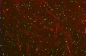 ep microtubulosaccion