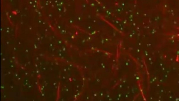 ep microtubulosaccion