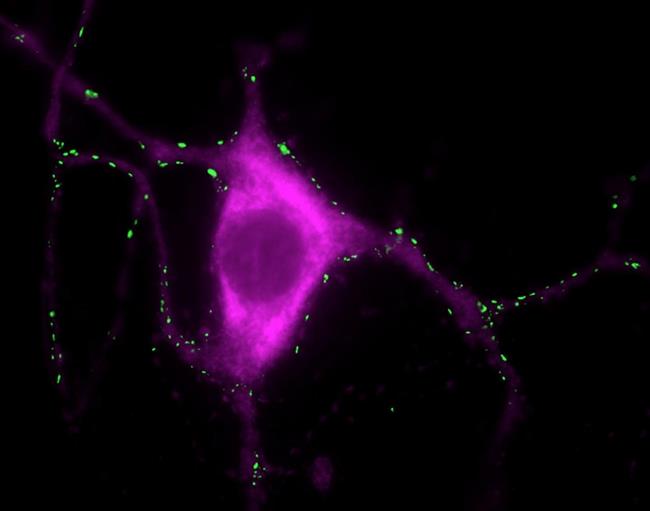 ep neurona