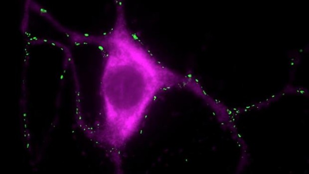 ep neurona