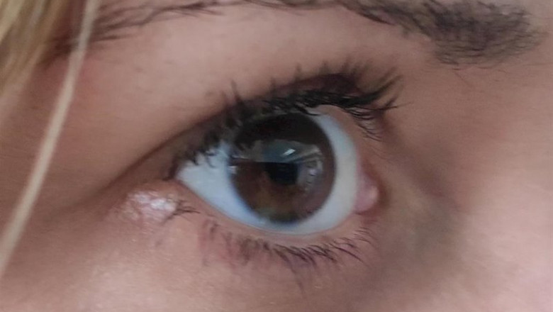 ep ojo