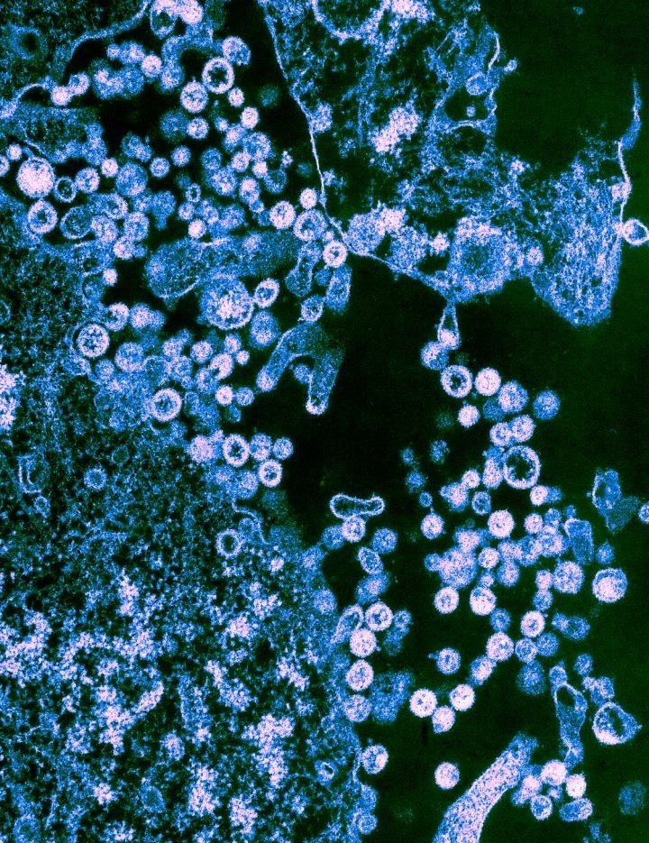 ep las particulas de la cepa josiah del virus lassa redondo se muestran en gemacion de las celulas