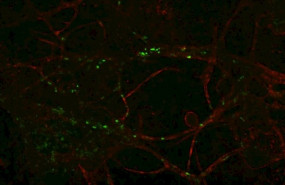 ep las primeras celulas inmunes del cuerpo fueron disenadas para que brillaran en verde cuando