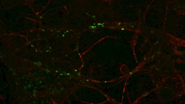 ep las primeras celulas inmunes del cuerpo fueron disenadas para que brillaran en verde cuando