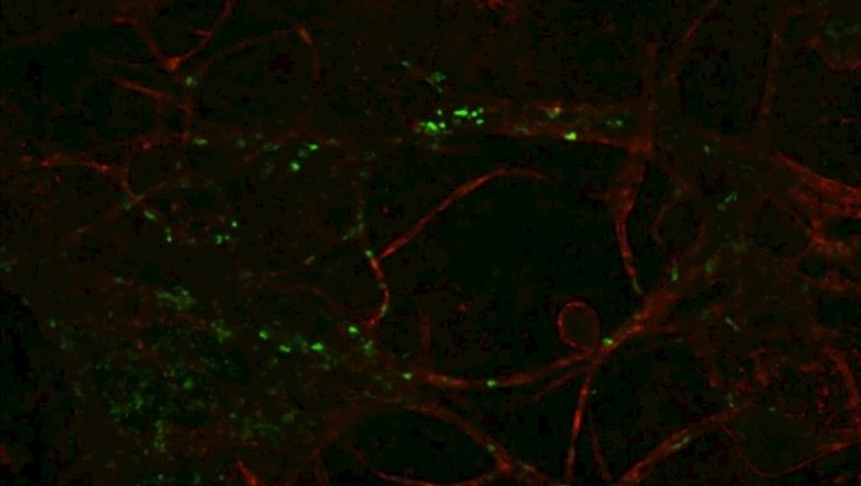 ep las primeras celulas inmunes del cuerpo fueron disenadas para que brillaran en verde cuando