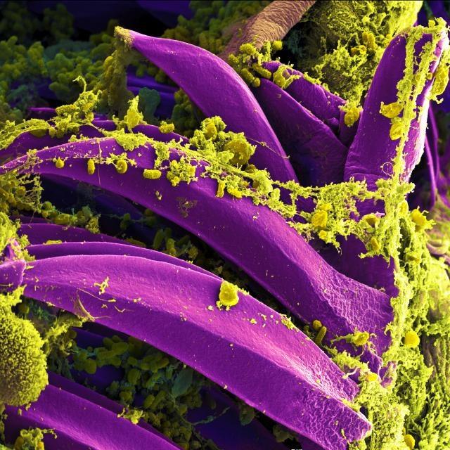 ep bacteriala peste yersinia pestis