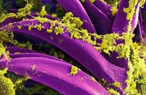 ep bacteriala peste yersinia pestis