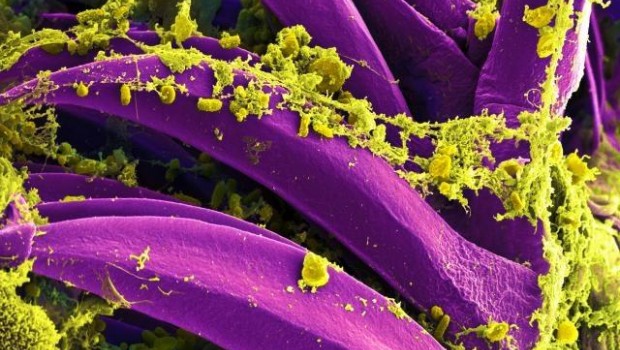ep bacteriala peste yersinia pestis