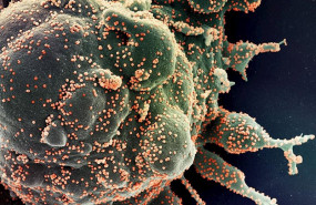 ep micrografia electronica de barrido coloreada de una celula apoptotica en verde infectada con