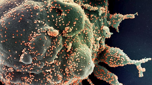 ep micrografia electronica de barrido coloreada de una celula apoptotica en verde infectada con