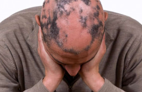 1599770593 efectos secundarios cirugia min 1599770593 efectos secundarios cirugia min