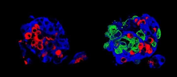 Un islote de Langerhans estándar, y derecha: un "super islote". Las células de insulina (células beta) están en azul y las células de glucagón (células alfa) en rojo; el «superislote» tiene, además, células epiteliales amnióticas, en verde. | © UNIGE ep un islote de langerhans estandar y derecha un super islote las celulas de insulina celulas beta