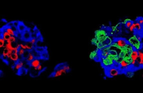 ep un islote de langerhans estandar y derecha un super islote las celulas de insulina celulas beta