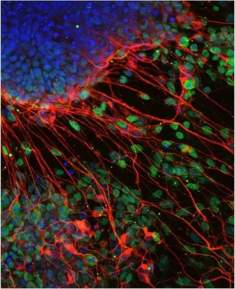 ep neuronas derivadas de celulas madre en ausencia de factores t-box