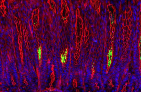 ep seccion transversaltravesla mucosa gastricaun raton la bacteria helicobacter pylori verde colonizacavidadeslas glandulas gastricas los nucleoslas celulasla membrana mucosa estan representadosazul su citoesqueleto en