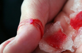 ep sangre herida