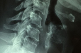 1576488065 ciclo superior en imagen para el diagn stico y medicina nuclear