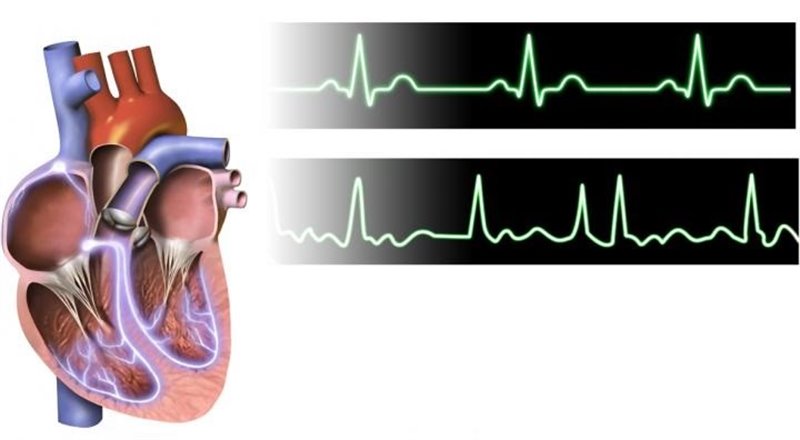 ep corazon y electrocardiograma