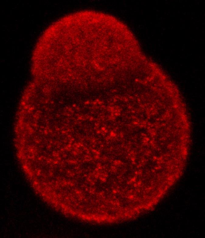 Hongo patógeno | CENTRO NACIONAL DE MICROBIOLOGÍA DEL INSTITUTO DE ep hongo patogeno