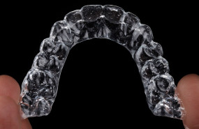 aligner gab3829b8e 1280