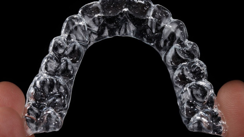 aligner gab3829b8e 1280