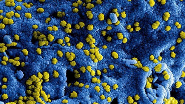 ep micrografia electronica de escaneo a color de las particulas del virus del sindrome respiratorio
