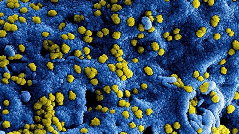 ep micrografia electronica de escaneo a color de las particulas del virus del sindrome respiratorio