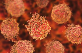 ep celulas en el cancer de prostata 20200305190203